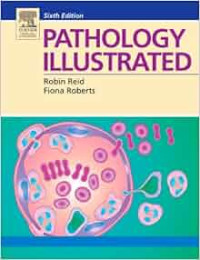 Pathology illustrated