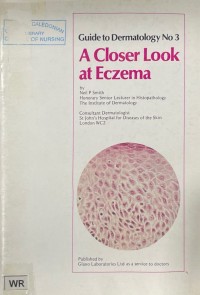 Guide to Dermatology No. 3: A Closer Look At Eczema