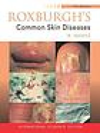 Roxburgh's common skin diseases