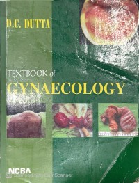 Textbook of Gynaecology